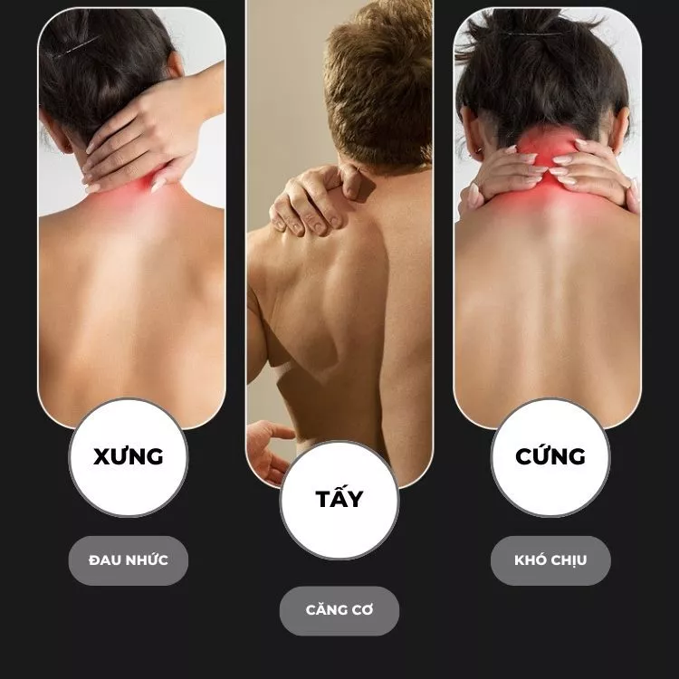 Tổng quan tính năng máy massage cổ SiaaSoo
